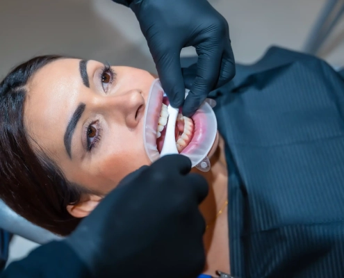 Examen dentaire en cours avec écarteur buccal.