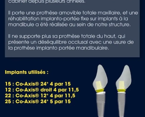 Cas clinique dentaire avec implants Co-Axis.