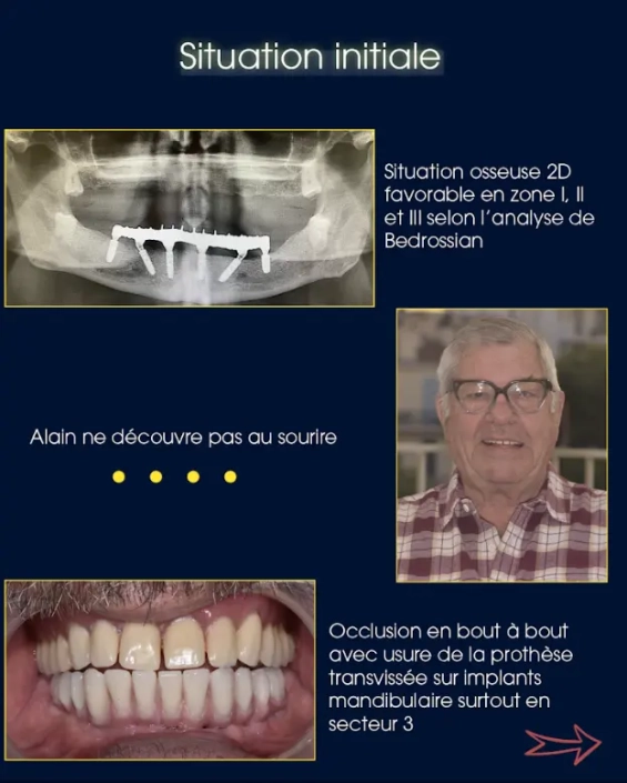 Radiographie dentaire et homme souriant avec prothèse.
