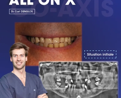 cas clinique dr. denglos 1 Sourire, radiographie dentaire, docteur en blouse.