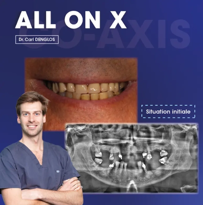 cas clinique dr. denglos 1 Sourire, radiographie dentaire, docteur en blouse.