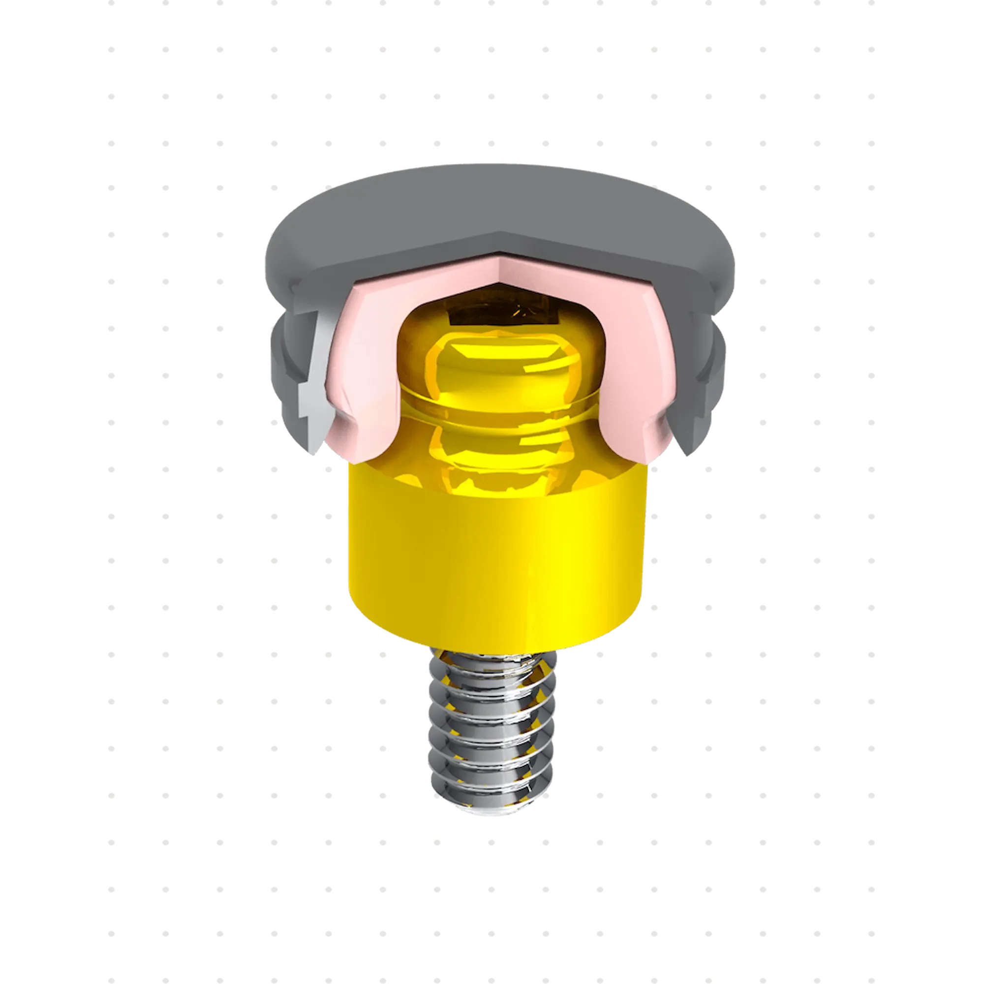 Implant dentaire vissé avec partie supérieure grise.