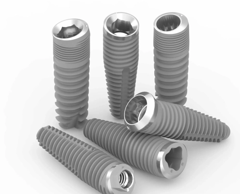 Vis dentaires implantées en groupe sur fond blanc.