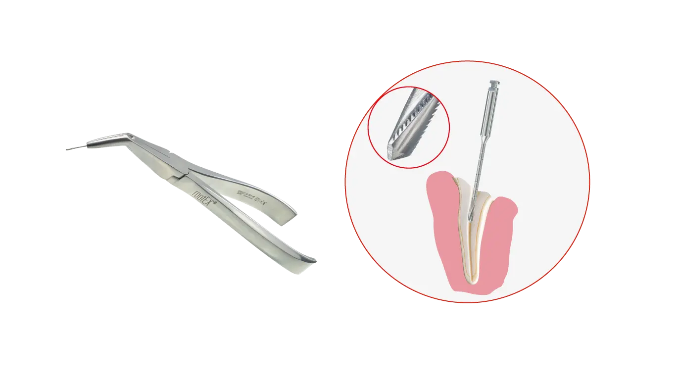 Pince et outil dentaire durant une extraction.