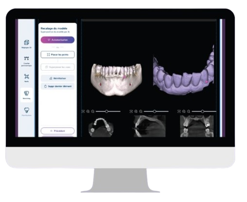 Logiciel dentaire affiché sur un écran d'ordinateur.