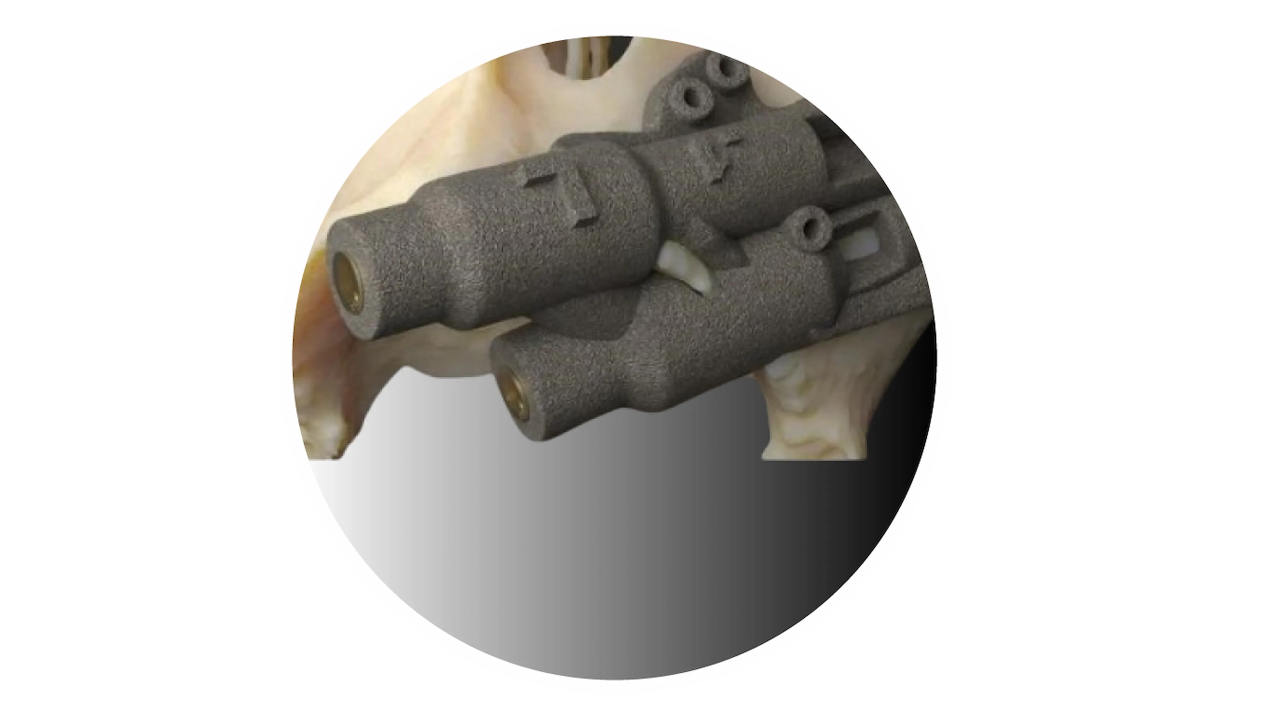 Prothèse auditive imprimée en 3D sur crâne.